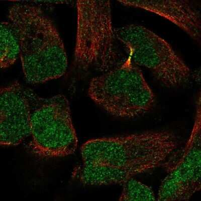 Immunocytochemistry/Immunofluorescence: PKNOX2 Antibody [NBP2-55463] - Staining of human cell line RH-30 shows localization to nucleus & cytokinetic bridge. Antibody staining is shown in green.