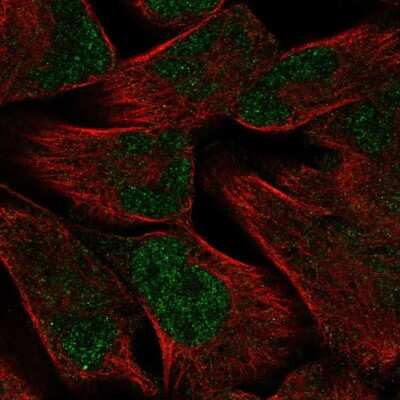 Immunocytochemistry/Immunofluorescence: PKNOX2 Antibody [NBP2-56791] - Staining of human cell line RH-30 shows localization to nucleoplasm.