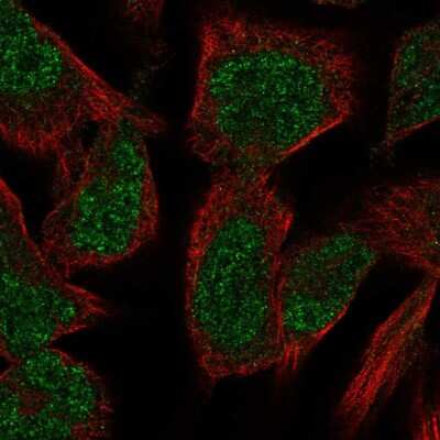 Immunocytochemistry/Immunofluorescence: PKNOX2 Antibody [NBP2-57402] - Staining of human cell line RH-30 shows localization to nucleoplasm.