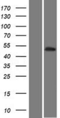 Western Blot: PKNOX2 Overexpression Lysate (Adult Normal) [NBP2-06480] Left-Empty vector transfected control cell lysate (HEK293 cell lysate); Right -Over-expression Lysate for PKNOX2.