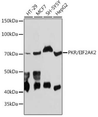 Western Blot: PKR Antibody (5B7B6) [NBP3-15767] - Western blot analysis of extracts of various cell lines, using PKR antibody (NBP3-15767) at 1:1000 dilution. Secondary antibody: HRP Goat Anti-Rabbit IgG (H+L) at 1:10000 dilution. Lysates/proteins: 25ug per lane. Blocking buffer: 3% nonfat dry milk in TBST. Detection: ECL Basic Kit. Exposure time: 30s.