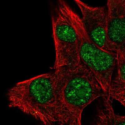 Immunocytochemistry/Immunofluorescence: PLA1A Antibody [NBP2-58599] - Staining of human cell line SK-MEL-30 shows localization to nuclear speckles & cytoplasmic bodies.