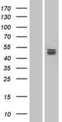 Western Blot: PLA1A Overexpression Lysate (Adult Normal) [NBP2-07115] Left-Empty vector transfected control cell lysate (HEK293 cell lysate); Right -Over-expression Lysate for PLA1A.