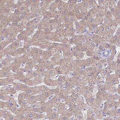 Immunohistochemistry-Paraffin: PLA2G12B Antibody [NBP2-31685] - Staining of human liver shows moderate cytoplasmic positivity in hepatocytes.