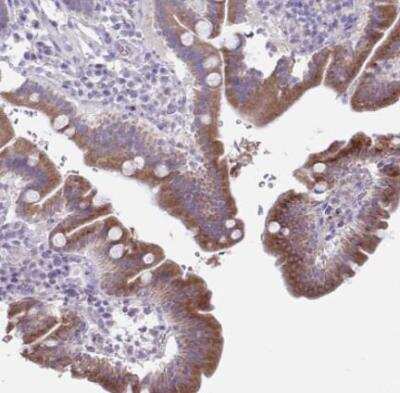 Immunohistochemistry-Paraffin PLA2G12B Antibody