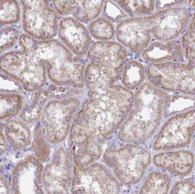 Immunohistochemistry-Paraffin PLA2G12B Antibody