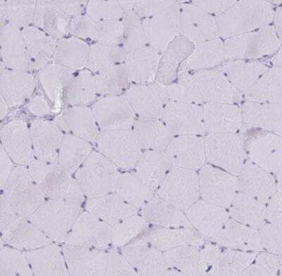 Immunohistochemistry-Paraffin PLA2G12B Antibody