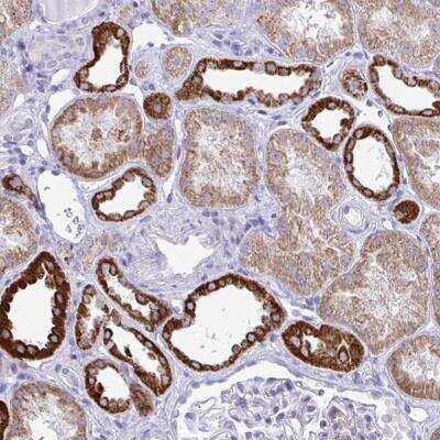Immunohistochemistry-Paraffin: PLA2G12B Antibody [NBP2-31780] - Staining of human kidney shows strong cytoplasmic positivity in distal tubules.