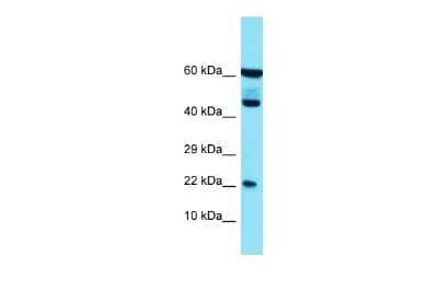 Western Blot: PLA2G12B Antibody [NBP2-85484] - Host: Rabbit. Target Name: PLA2G12B. Sample Type: HT1080 Whole Cell lysates. Antibody Dilution: 1.0ug/ml