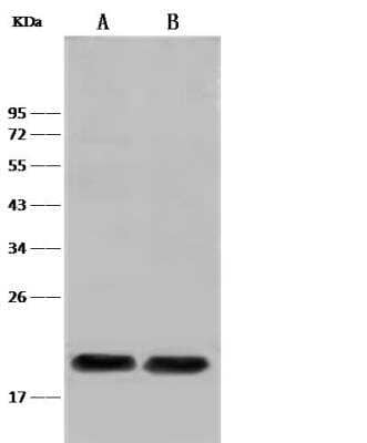 Western Blot: PLA2G12B Antibody [NBP2-99414] - Lane A: Mouse liver tissue lysateLane B: HT1080 Whole Cell LysateLysates/proteins at 30 ug per laneSecondaryGoat Anti-Rabbit IgG (H+L)/HRP at 1/10000 dilution.Developed using the ECL technique. Performed under reducing conditions.Predicted band size:22 kDaObserved band size:22 kDa