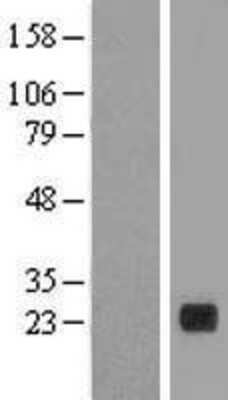 Western Blot: PLA2G12B Overexpression Lysate (Adult Normal) [NBL1-14470] Left-Empty vector transfected control cell lysate (HEK293 cell lysate); Right -Over-expression Lysate for PLA2G12B.