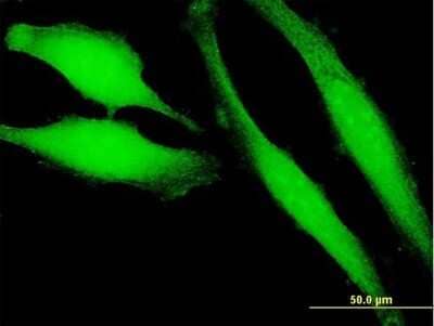 Immunocytochemistry/Immunofluorescence: PLA2G16/HRASLS3 Antibody [H00011145-B01P] - Analysis of purified antibody to HRASLS3 on HeLa cell. (antibody concentration 10 ug/ml)