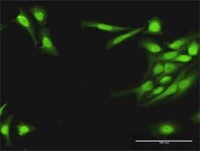 Immunocytochemistry/Immunofluorescence: PLA2G16/HRASLS3 Antibody [H00011145-D01P] - Analysis of antibody to PLA2G16 on HeLa cell. Antibody concentration 30 ug/ml.