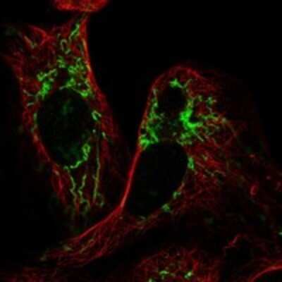 Immunocytochemistry/Immunofluorescence: PLA2G16/HRASLS3 Antibody [NBP3-17754] - Staining of human cell line U-2 OS shows localization to mitochondria.