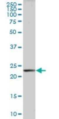 Western Blot: PLA2G16/HRASLS3 Antibody [H00011145-B01P] - Analysis of HRASLS3 expression in human placenta.