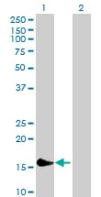 Western Blot: PLA2G16/HRASLS3 Antibody [H00011145-B01P] - Analysis of PLA2G16 expression in transfected 293T cell line by PLA2G16 polyclonal antibody.  Lane 1: HRASLS3 transfected lysate(17.82 KDa). Lane 2: Non-transfected lysate.