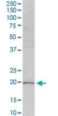 Western Blot: PLA2G16/HRASLS3 Antibody [H00011145-D01P] - Analysis of PLA2G16 expression in NIH/3T3.