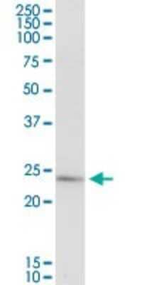 Western Blot: PLA2G16/HRASLS3 Antibody [H00011145-D01P] - Analysis of PLA2G16 expression in human spleen.