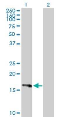 Western Blot: PLA2G16/HRASLS3 Antibody [H00011145-D01P] - Analysis of PLA2G16 expression in transfected 293T cell line by PLA2G16 polyclonal antibody.Lane 1: HRASLS3 transfected lysate(17.90 KDa).Lane 2: Non-transfected lysate.