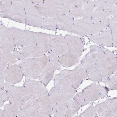 Immunohistochemistry-Paraffin: PLA2G1B Antibody [NBP2-32569] - Staining of human skeletal muscle shows low expression as expected.