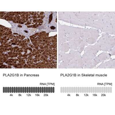 Immunohistochemistry-Paraffin: PLA2G1B Antibody [NBP2-32569] - Staining in human pancreas and skeletal muscle tissues using anti-PLA2G1B antibody. Corresponding PLA2G1B RNA-seq data are presented for the same tissues.