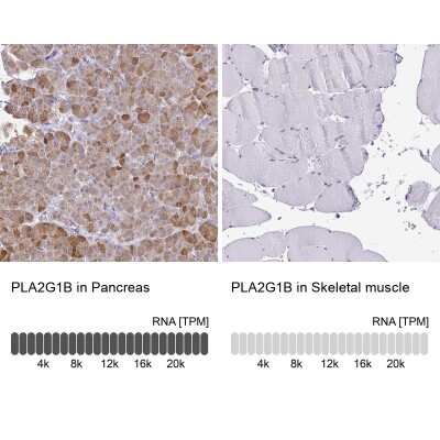 <b>Orthogonal Strategies Validation. </b>Immunohistochemistry-Paraffin: PLA2G1B Antibody [NBP2-33501] - Staining in human pancreas and skeletal muscle tissues using anti-PLA2G1B antibody. Corresponding PLA2G1B RNA-seq data are presented for the same tissues.