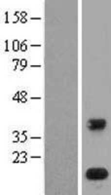 Western Blot: PLA2G1B Overexpression Lysate (Adult Normal) [NBL1-14471] Left-Empty vector transfected control cell lysate (HEK293 cell lysate); Right -Over-expression Lysate for PLA2G1B.