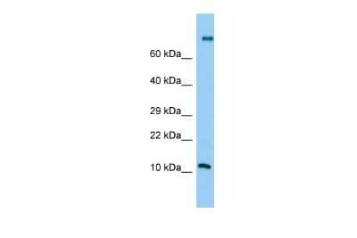 Western Blot: PLA2G2C Antibody [NBP3-09554] - Western blot analysis of PLA2G2C in Jurkat Whole Cell lysates. Antibody dilution at 1.0ug/ml