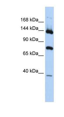 Western Blot: PLA2G4B Antibody [NBP1-80112] - Titration: 0.2-1 ug/ml, Positive Control: Human brain.