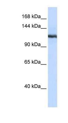 Western Blot: PLA2G4B Antibody [NBP1-80305] - 293T cells lysate, concentration 0.2-1 ug/ml.
