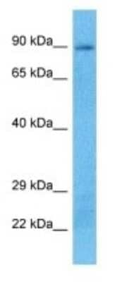 Western Blot: PLA2G4B Antibody [NBP3-09418] - Western blot analysis of PLA2G4B in MCF7 Whole Cell lysates. Antibody dilution at 1.0ug/ml