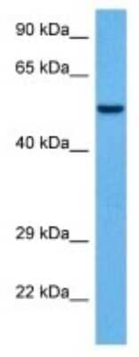 Western Blot: PLA2G4B Antibody [NBP3-10014] - Western blot analysis of PLA2G4B in Human 786-0 Whole Cell lysates. Antibody dilution at 1ug/ml