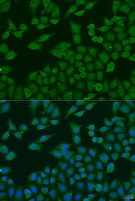 Immunocytochemistry/ Immunofluorescence PLA2G4C Antibody - BSA Free