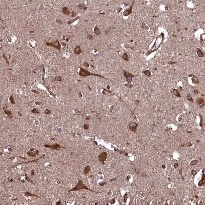 Immunohistochemistry-Paraffin PLA2G4C Antibody - BSA Free