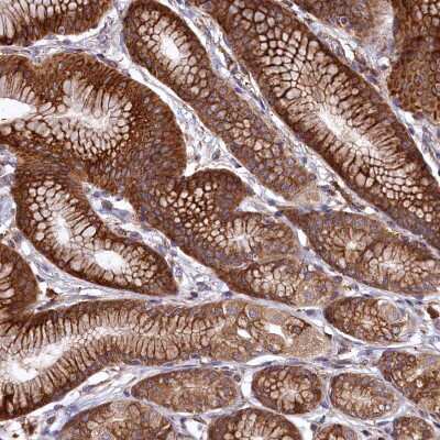 Immunohistochemistry-Paraffin PLA2G4C Antibody - BSA Free