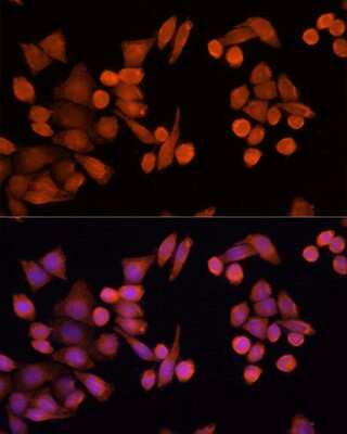 Immunocytochemistry/Immunofluorescence: PLA2G4D Antibody [NBP3-05082] - Analysis of Hela cells using PLA2G4D antibody at dilution of 1:100 (40x lens). Blue: DAPI for nuclear staining.