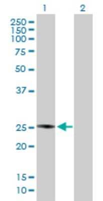 Western Blot: PLA2G4D Antibody [H00283748-B01P] - Analysis of PLA2G4D expression in transfected 293T cell line by PLA2G4D polyclonal antibody.  Lane 1: PLA2G4D transfected lysate(23.76 KDa). Lane 2: Non-transfected lysate.