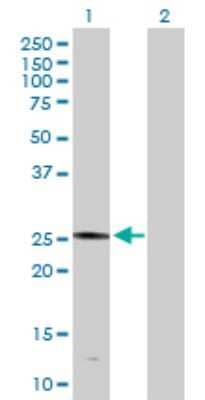 Western Blot: PLA2G4D Antibody [H00283748-D01P] - Analysis of PLA2G4D expression in transfected 293T cell line by PLA2G4D polyclonal antibody.Lane 1: PLA2G4D transfected lysate(24.40 KDa).Lane 2: Non-transfected lysate.