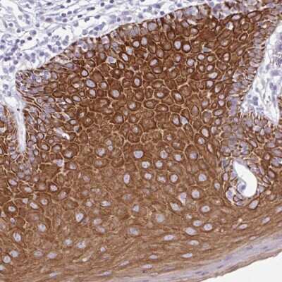 Immunohistochemistry: PLA2G4E Antibody [NBP2-32610] - Staining of human oral mucosa shows strong cytoplasmic positivity in squamous epithelial cells.