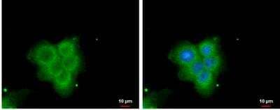 Immunocytochemistry/Immunofluorescence: PLA2G4F Antibody [NBP2-19855] - A431 cells were fixed in 4% paraformaldehyde at RT for 15 min. Green: PLA2G4F protein stained by PLA2G4F antibody [N3C2], Internal diluted at 1:500. Blue: Hoechst 33342 staining.