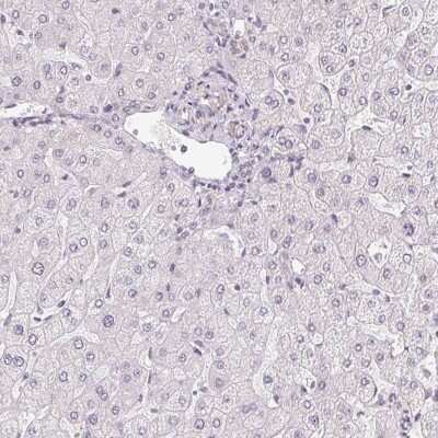 Immunohistochemistry-Paraffin PLA2G4F Antibody - BSA Free