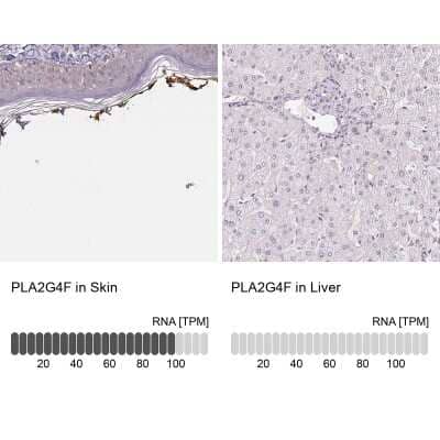 Immunohistochemistry-Paraffin PLA2G4F Antibody - BSA Free