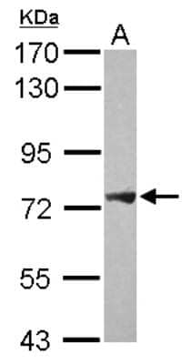 Western Blot: PLA2G4F Antibody [NBP2-19854] - Sample (30 ug of whole cell lysate) A: Raji 7. 5% SDS PAGE gel, diluted at 1:1000.