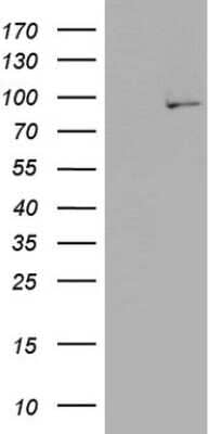 Western Blot PLA2G6 Antibody (OTI10G4)