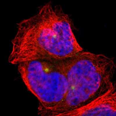 Immunocytochemistry/Immunofluorescence: PLA2G6 Antibody [NBP1-81586] - Staining of human cell line A-431 shows localization to microtubule organizing center. Antibody staining is shown in green.