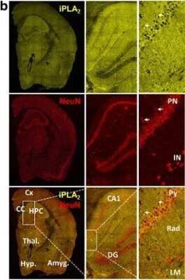 Immunohistochemistry: PLA2G6 Antibody [NBP1-81586] - Non-Tg mouse brains were dissected, fixed in 4% paraformaldehyde, cryoprotected, frozen, & sectioned coronally (8 um sections). Representative immunofluorescence images taken from brain coronal sections (Bregma -2) using phospho-cPLA2 (yellow) antibody and DAPI (blue) (a) or and iPLA2 (yellow) and NeuN (red) antibodies (b). Images show a whole hemibrain section using a 20x objective on a Nikon A1R VAAS inverted confocal (left panels). NeuN and iPLA2 co-localize within the perinucleus of pyramidal neurons (PN, white arrows), but not within the perinucleus of interneurons (IN). iPLA2 staining is also observed within pyramidal dendritic arborization (right panels) Image collected and cropped by CiteAb from the following publication (//actaneurocomms.biomedcentral.com/articles/10.1186/s40478-017-0460-6), licensed under a CC-BY license.