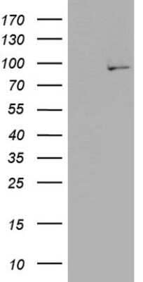 Western Blot: PLA2G6 Antibody (OTI10G4) - Azide and BSA Free [NBP2-73456] - Analysis of HEK293T cells were transfected with the pCMV6-ENTRY control (Left lane) or pCMV6-ENTRY PLA2G6.