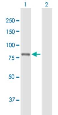 Western Blot: PLA2G6 Antibody [H00008398-B01P] - Analysis of PLA2G6 expression in transfected 293T cell line by PLA2G6 polyclonal antibody.  Lane 1: PLA2G6 transfected lysate(82.72 KDa). Lane 2: Non-transfected lysate.