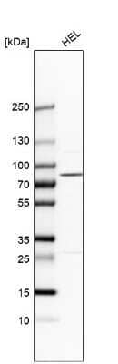 Western Blot: PLA2G6 Antibody [NBP1-81586] - Analysis in human cell line HEL.