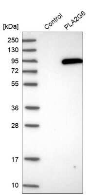 Western Blot: PLA2G6 Antibody [NBP1-81586] - Analysis in control (vector only transfected HEK293T lysate) and PLA2G6 over-expression lysate (Co-expressed with a C-terminal myc-DDK tag (3.1 kDa) in mammalian HEK293T cells).